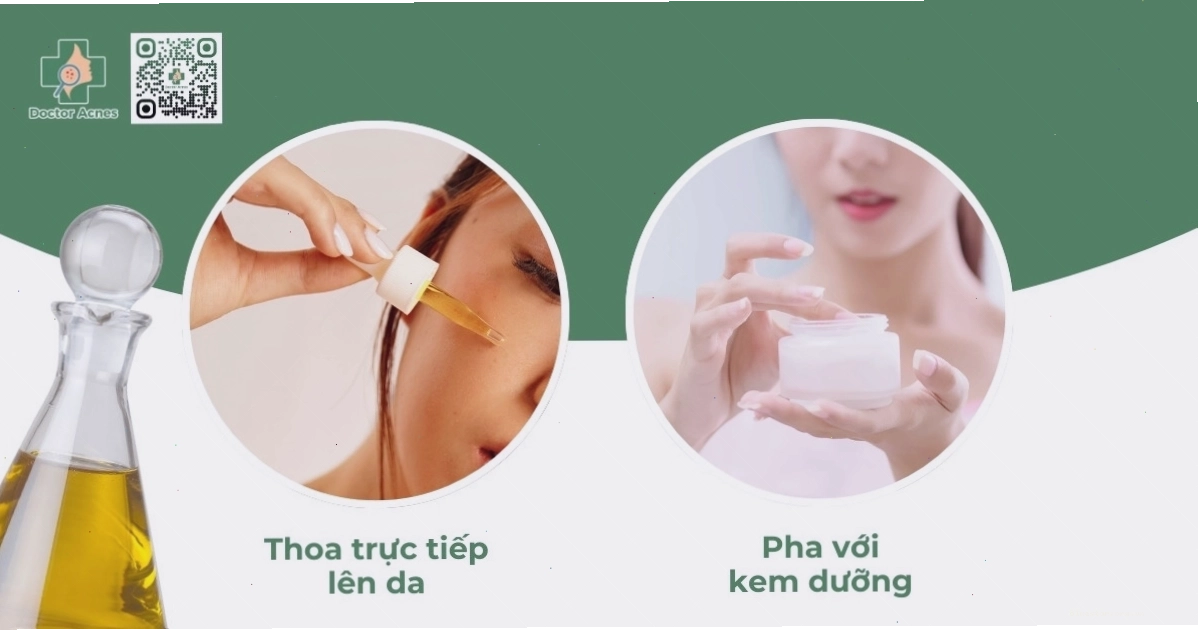 Dầu mù u giúp làm lành sẹo lõm và sẹo thâm hiệu quả