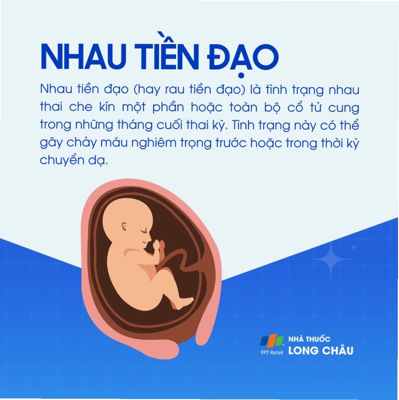 Hình ảnh minh họa tiền đạo trong trận đấu