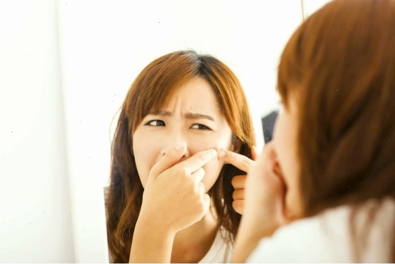 Quy trình chăm sóc da mụn đầu đen với các sản phẩm phù hợp