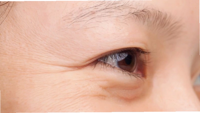 Retinol giúp làm giảm nếp nhăn trên da