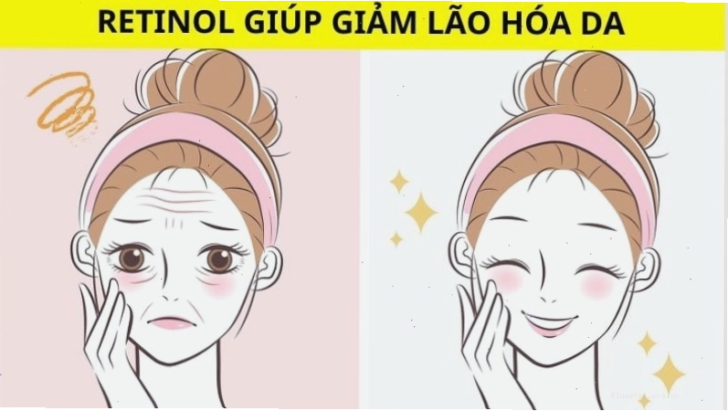 Retinol hỗ trợ ngăn ngừa lão hóa da hiệu quả