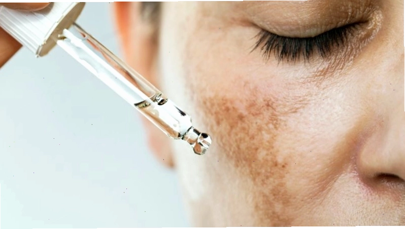 Sử dụng Retinol giúp cải thiện tình trạng tăng sắc tố da