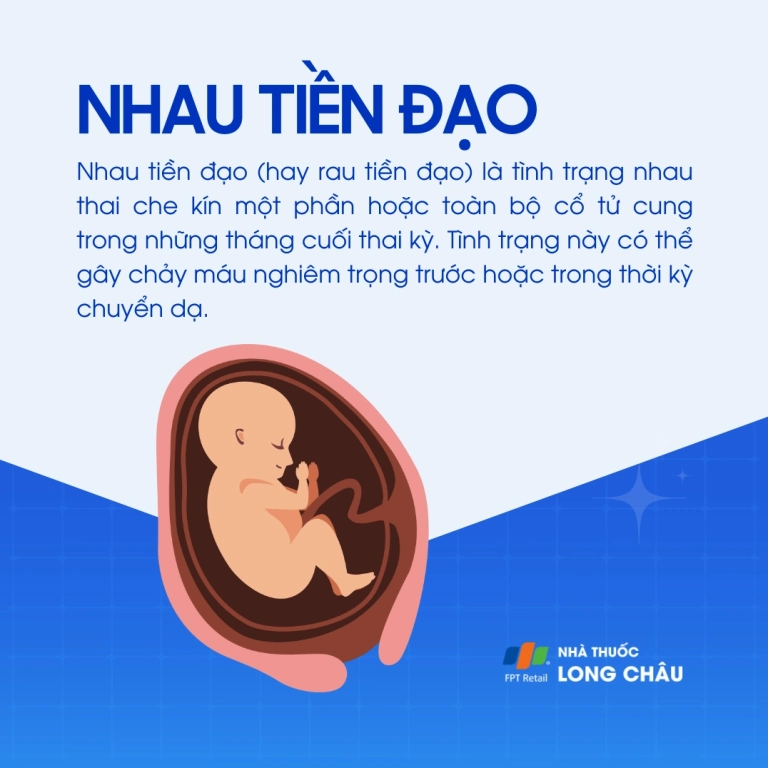Thám tử lừng danh Conan: Tiền đạo thứ 11 - Phân tích chi tiết và cốt truyện