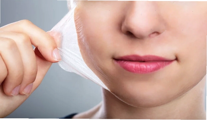 Ưu điểm của peel da trong việc cải thiện làn da